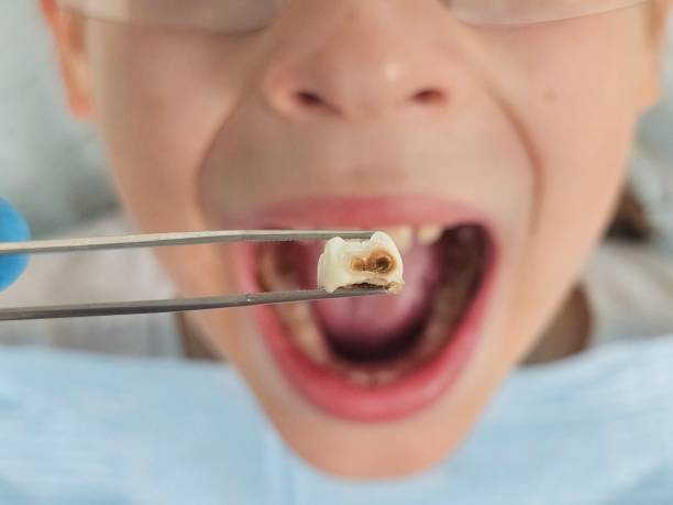 Best Emergency Broken Tooth Repair in Midland, NC